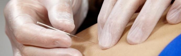 Learning To Like Needle Therapies For Fibromyalgia Trigger Purpose Treatment