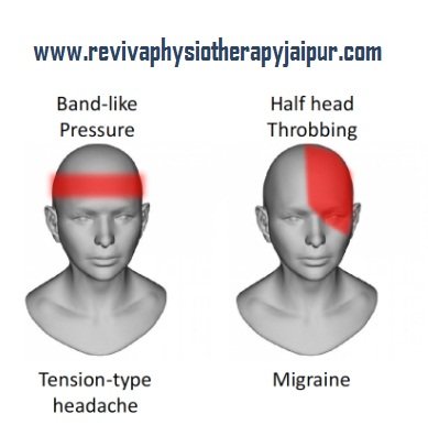 Difference between Migraine Headache and Tension Headache